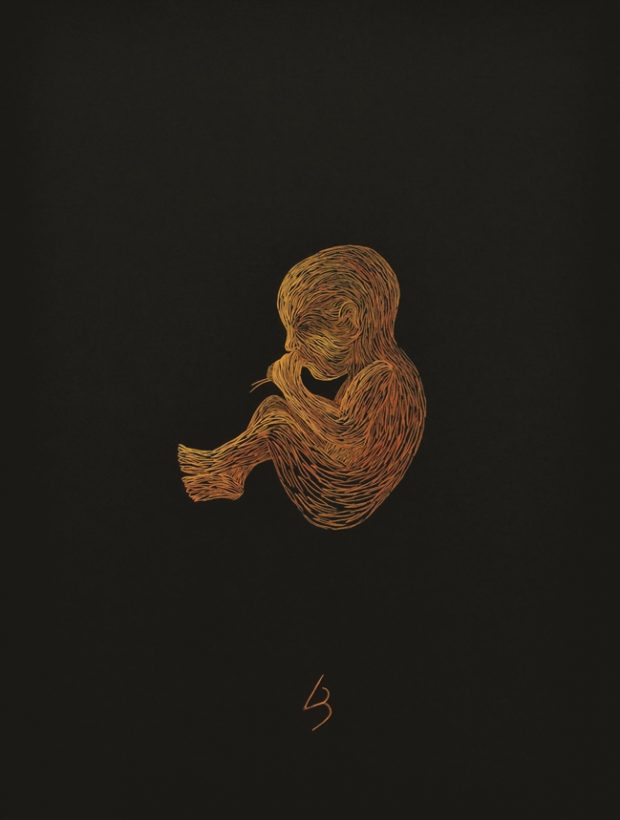 Linas Bražiūnas. Pušų spyglių kūdikis 2015 (akrilas, akvarelė, drobė), 80x60cm.